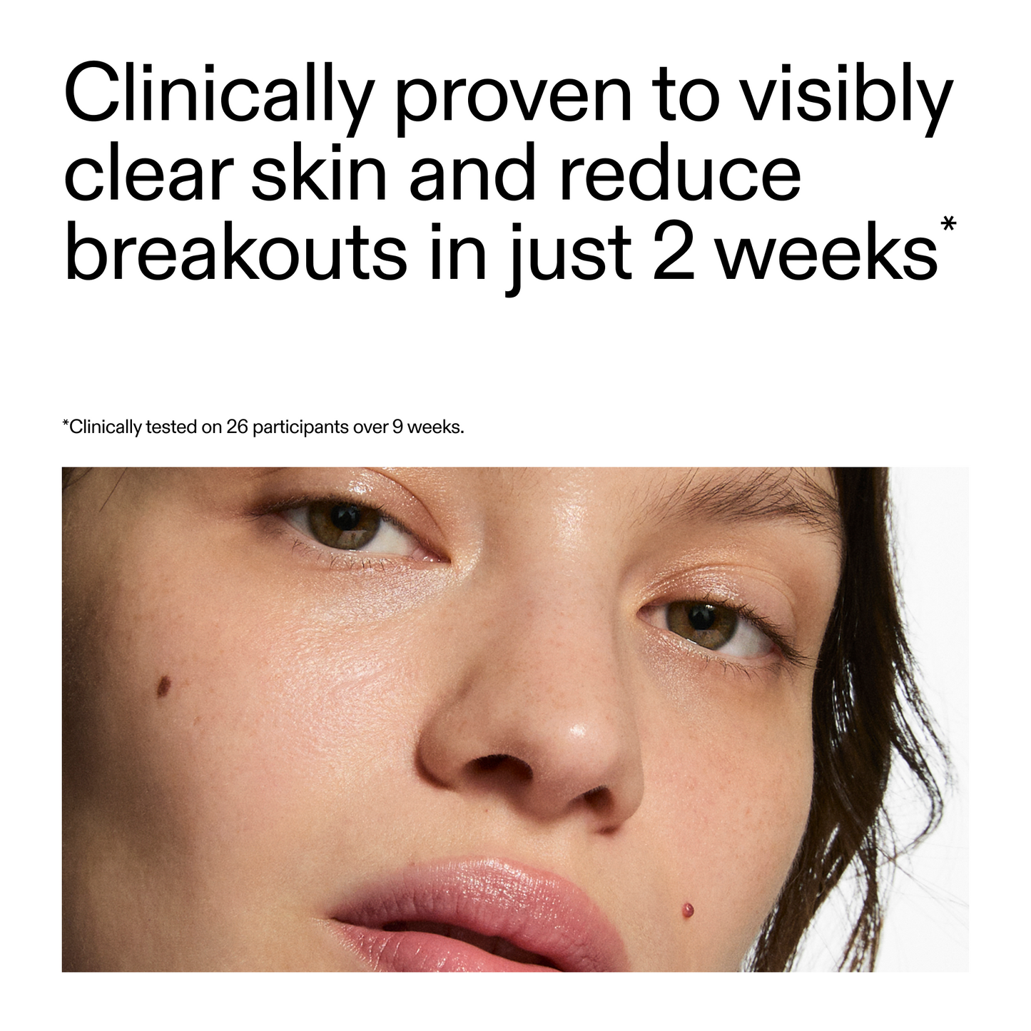 360-acne-clearing-duo-e9 360_Serum_Key_Claim.png