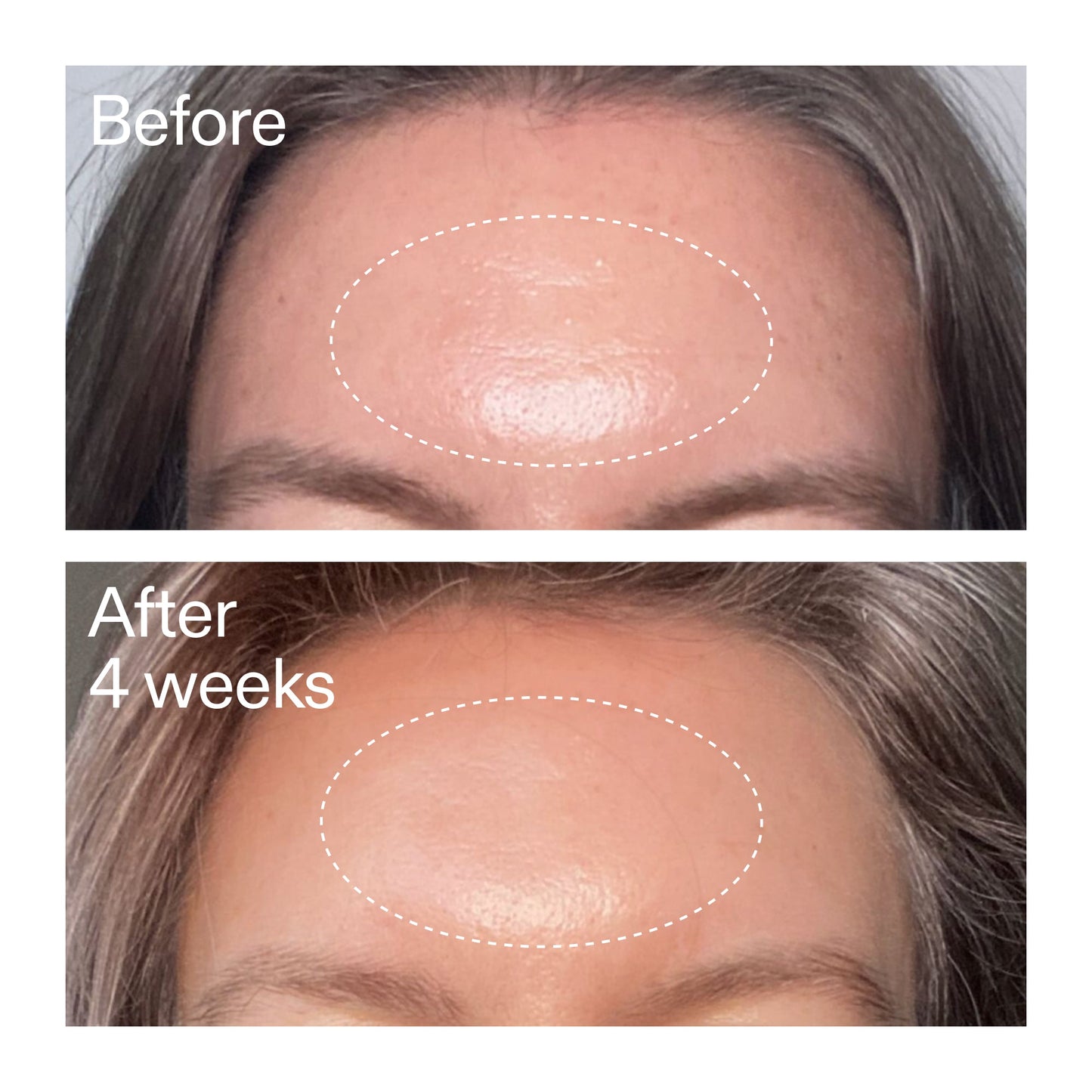 advanced-0-2-retinal-serum-d0 AdvancedRetinal_BeforeAfter1_2000x2000_1da6bb0a-29dd-41d1-95b7-8679696bbf0f.jpg