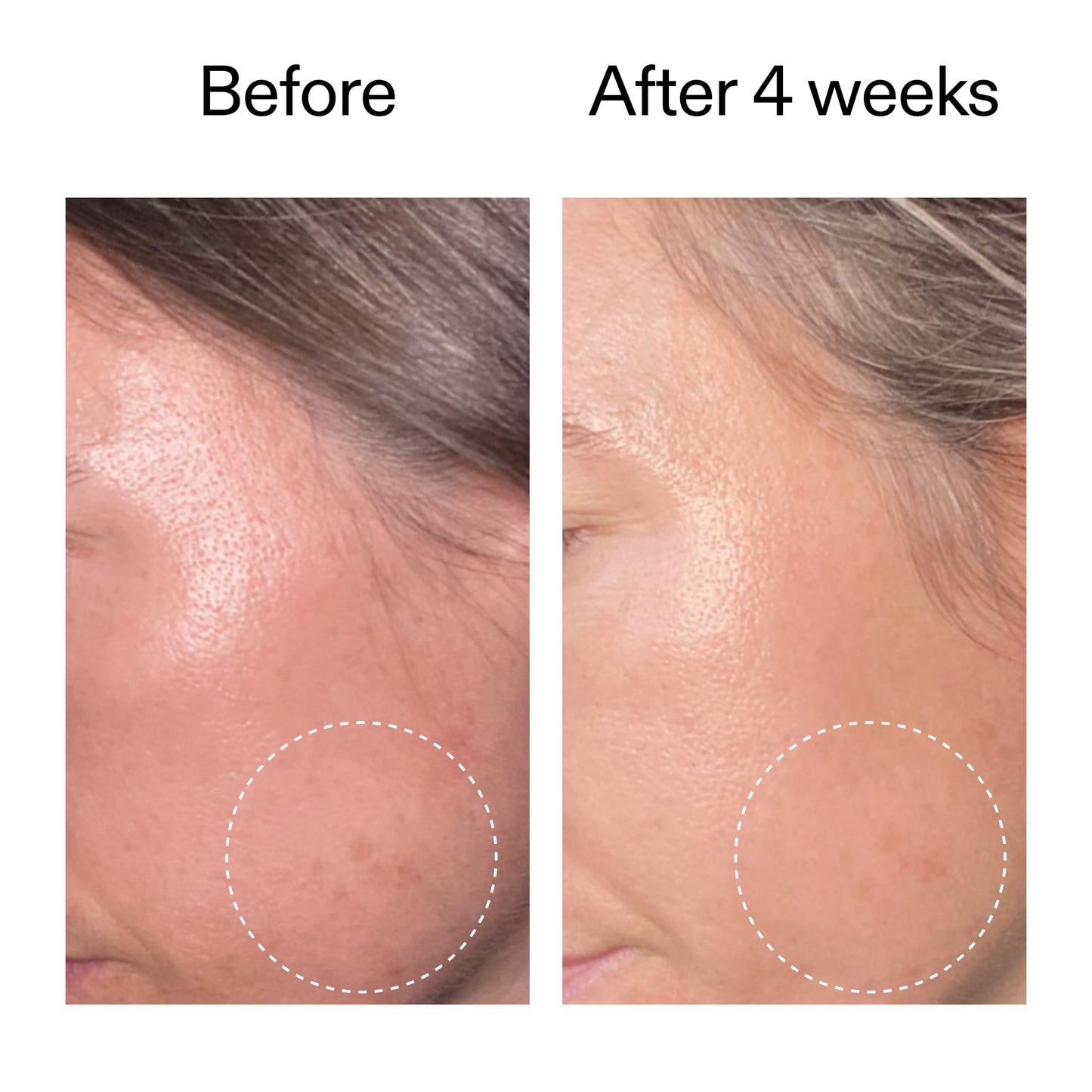 advanced-0-2-retinal-serum-d0 AdvancedRetinal_BeforeAfter2__2000x2000_62fb16bb-77ae-4d63-8500-88dbf847f4b9.jpg