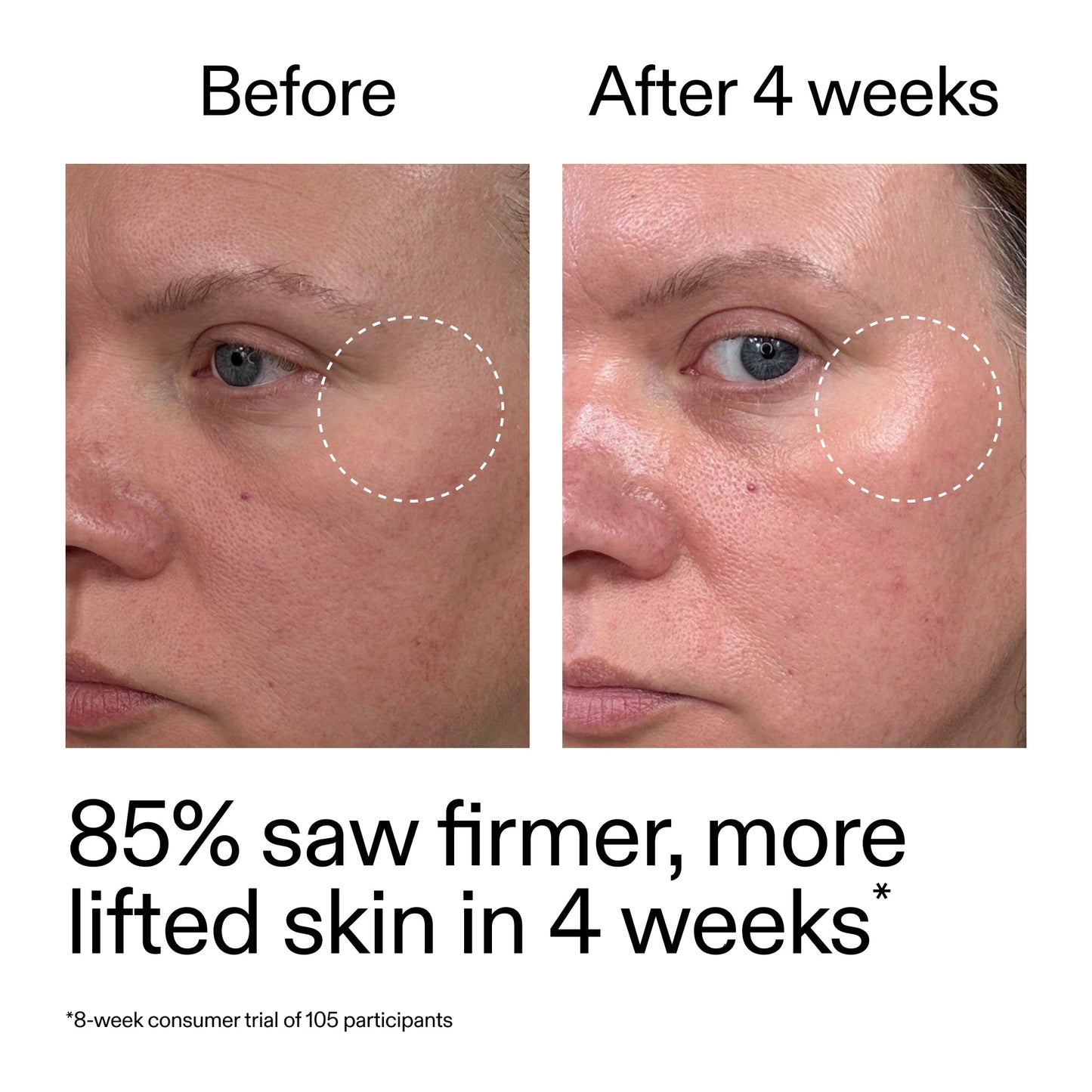 advanced-0-2-retinal-serum-duo-q4 AdvancedRetinal_BeforeAfter_Claim1_2000x2000_3a315aa8-f408-4b33-bbeb-0d9209f98404.jpg