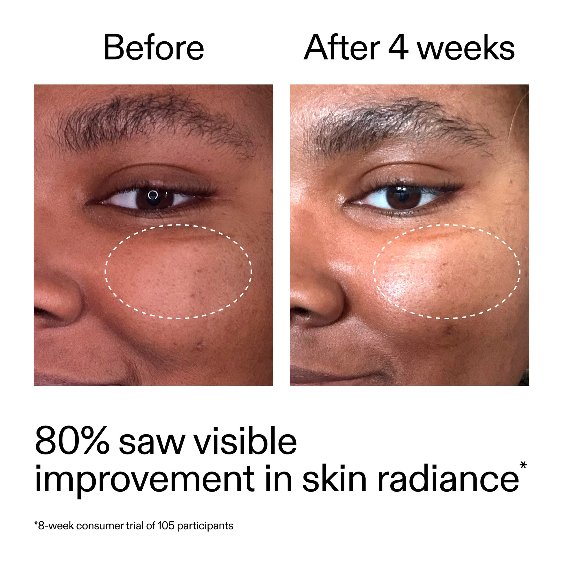advanced-0-2-retinal-serum-d0 AdvancedRetinal_BeforeAfter_Claim2_2000x2000_39d11e3d-eda9-44ec-ab32-2903b1a368bd.jpg