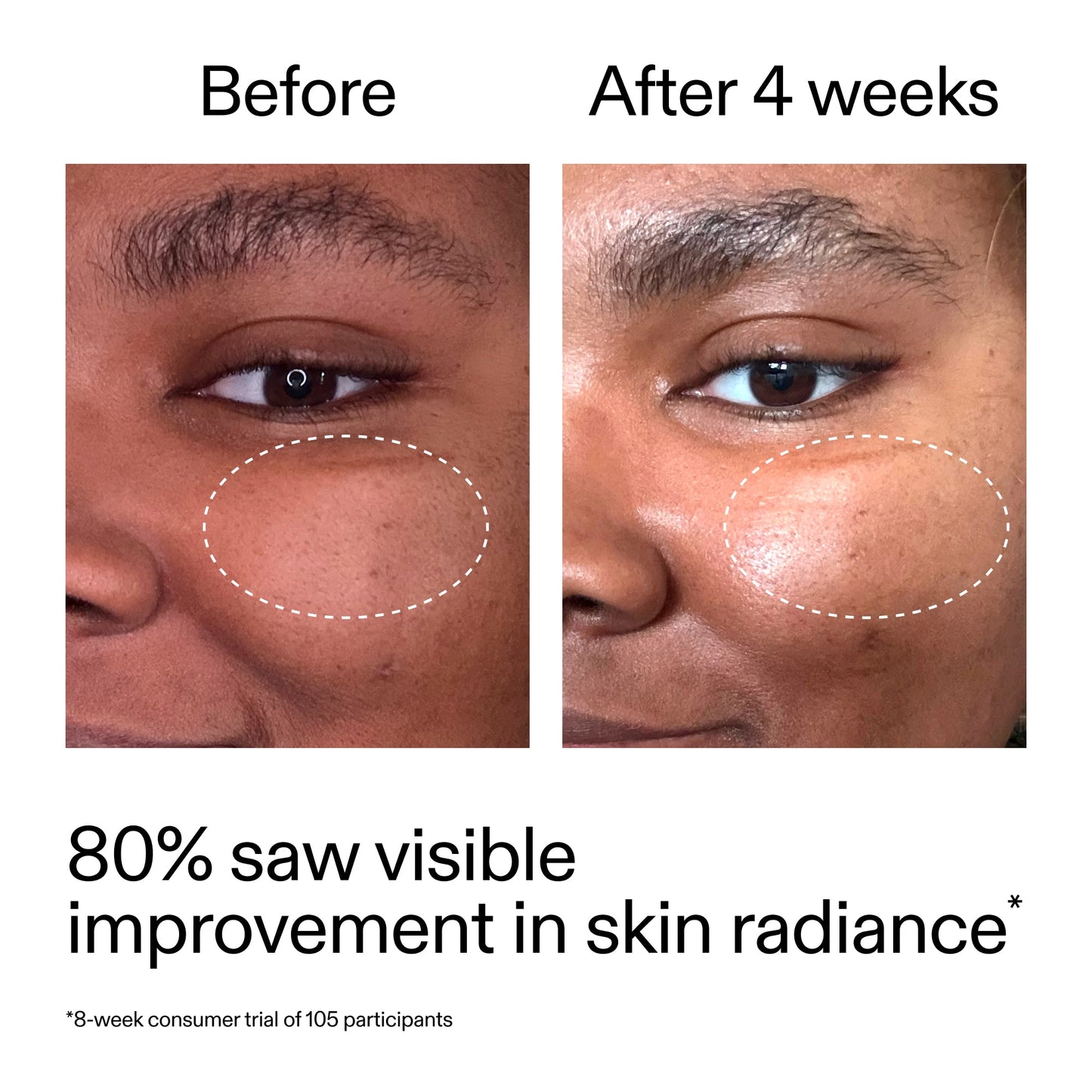 advanced-0-2-retinal-serum-duo-q4 AdvancedRetinal_BeforeAfter_Claim2_2000x2000_681b621d-8d44-4d44-9a40-89244f9b2e53.jpg