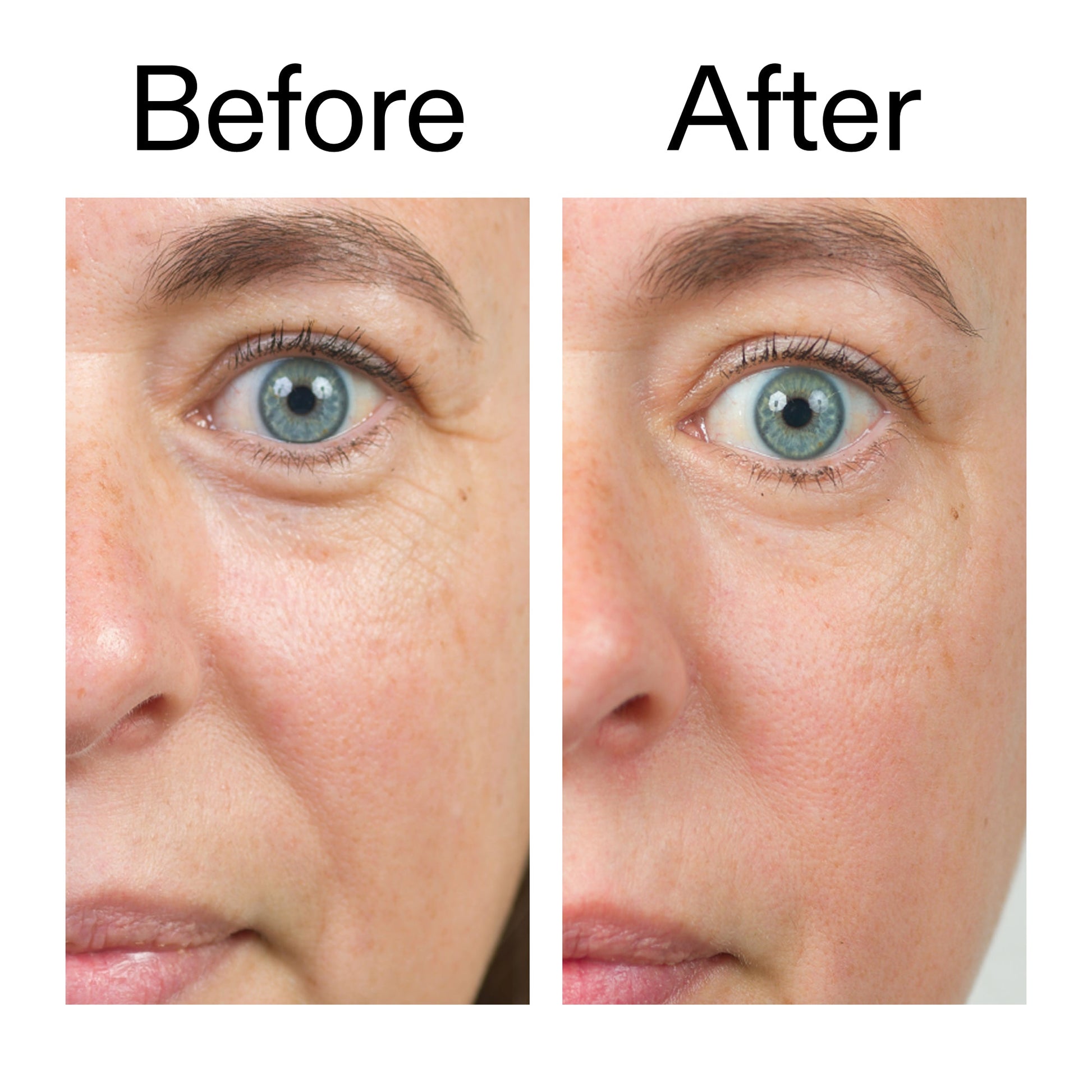 bio-active-ceramide-moisturizer-duo-f0 Bio-Active_Before_After_2000x2000_566e5a9e-135e-417a-8242-b44e5fa35463.jpg