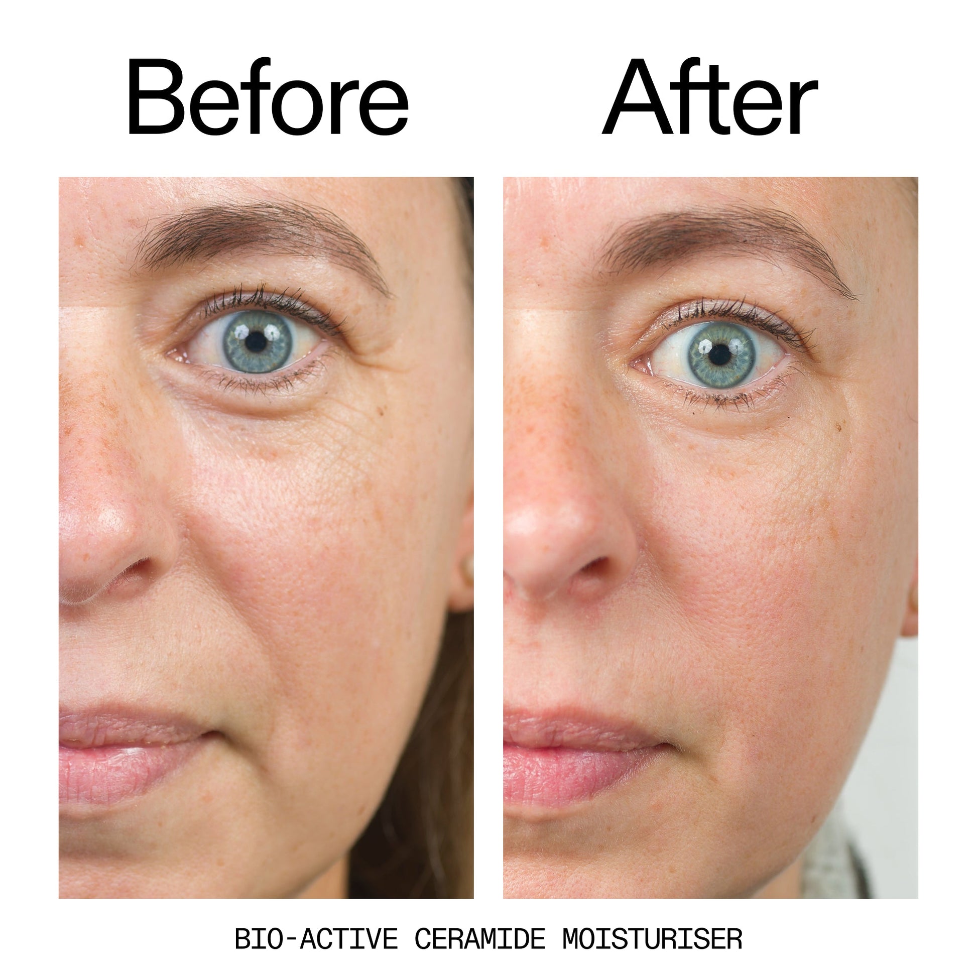 barrier-boosting-trio-a2 Bio-Active_Before_After_2000x2000_600947b4-e8c5-425a-9155-fc15bc83aa12.jpg