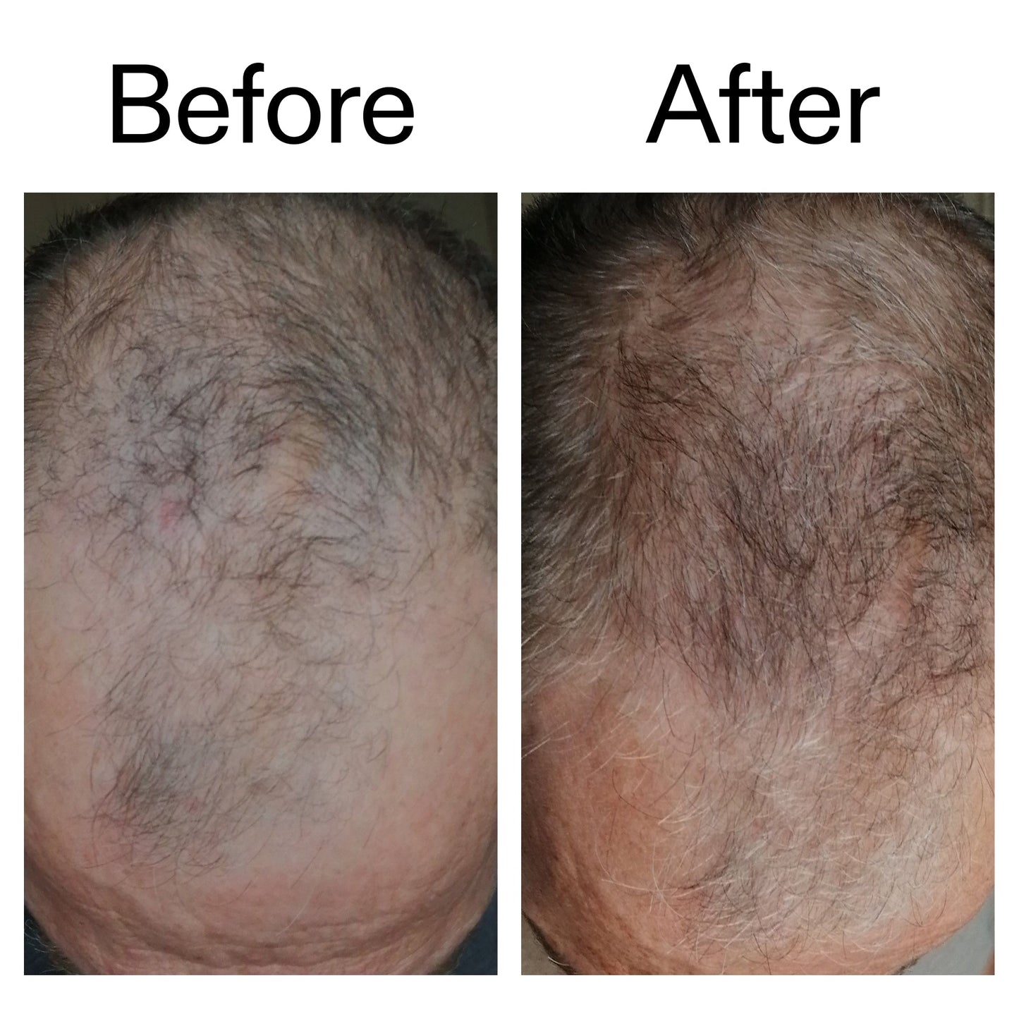 caffeine-stimulating-scalp-treatment-e8 Caffeine_Scalp_Treatment_B_A_Ppage_2000_x_2000.jpg