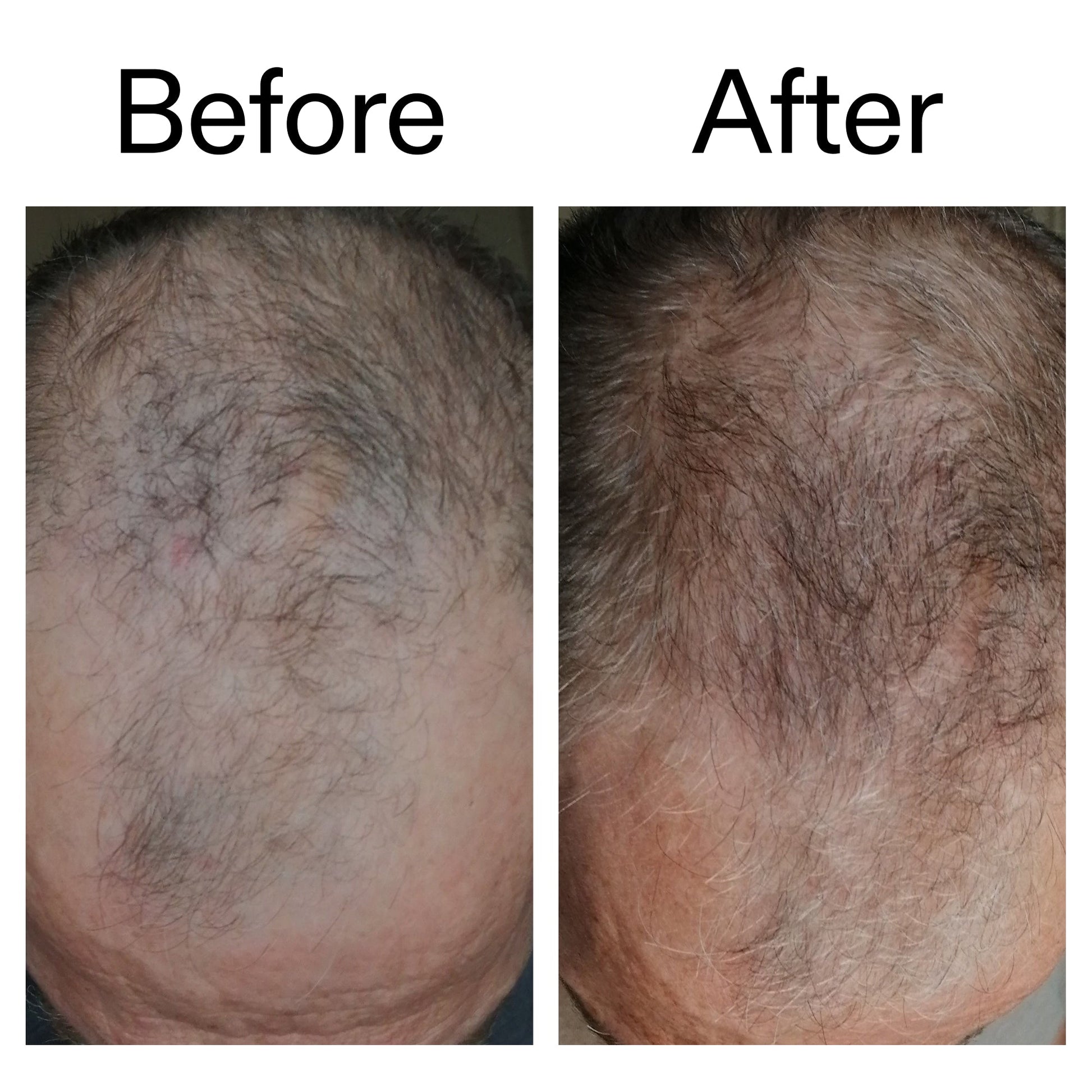 caffeine-stimulating-scalp-treatment-e8 Caffeine_Scalp_Treatment_B_A_Ppage_2000_x_2000.jpg