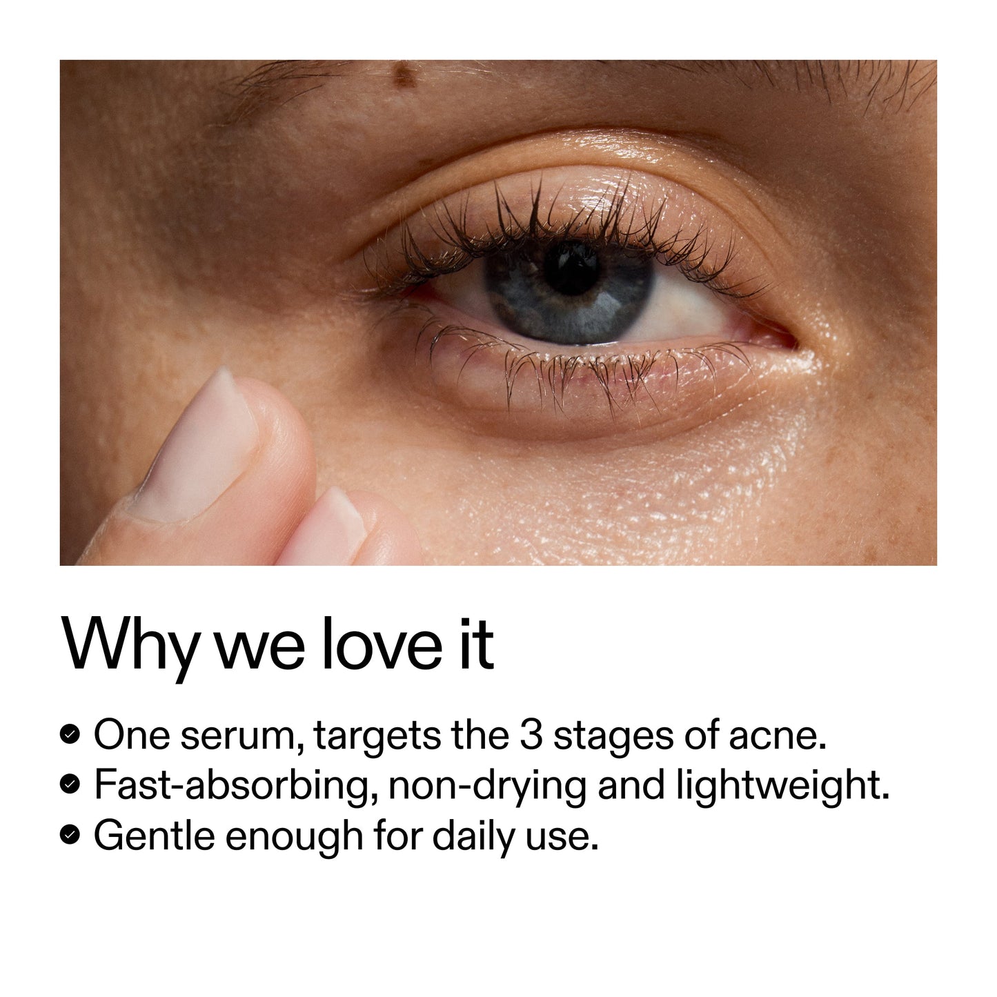360-acne-clearing-serum-b1 Dioic_Whyweloveit_2000x2000_175aafd3-0cbe-403a-b317-a8362881bfe2.jpg