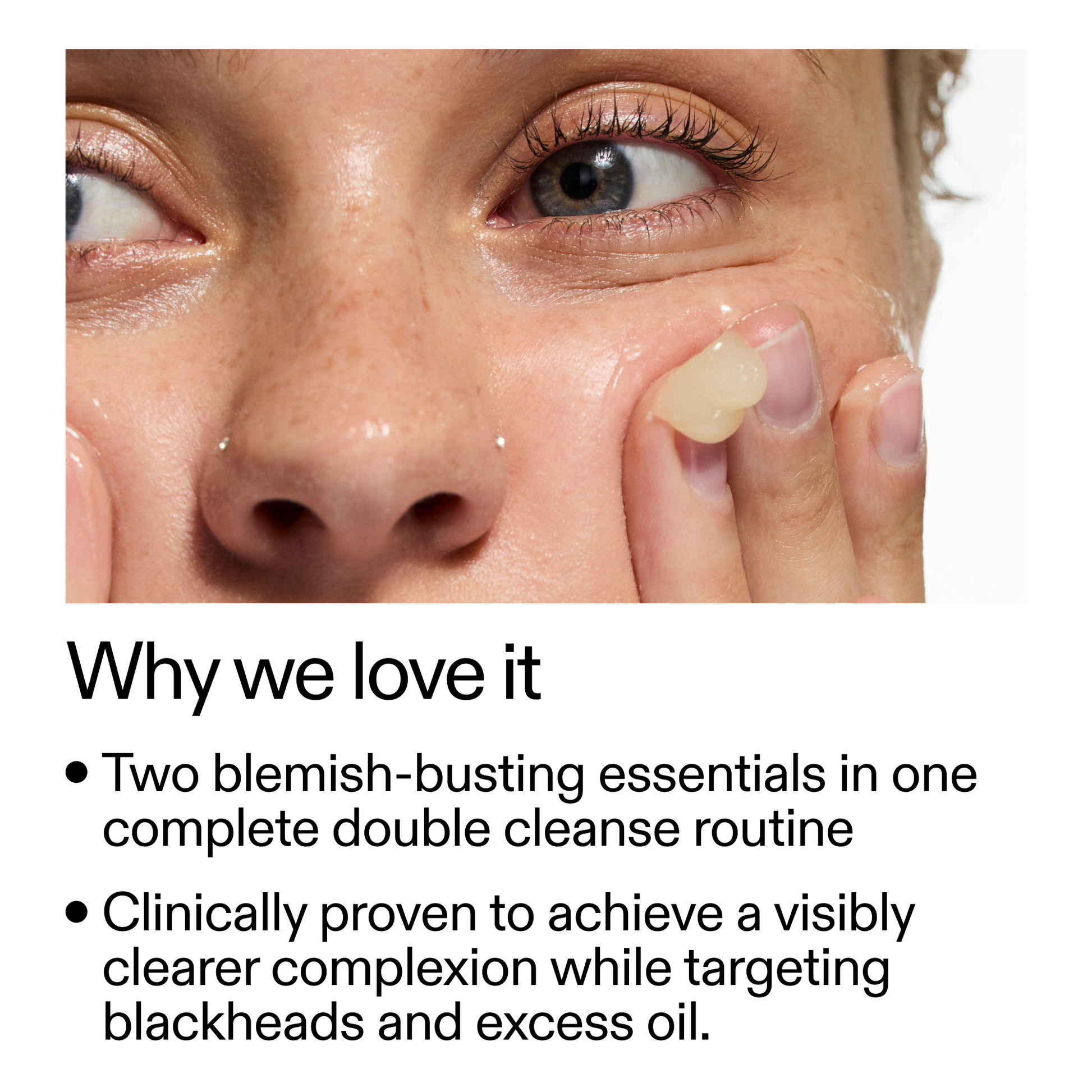 acne-double-cleanse-duo-q2 Double_Cleanse_Duo_for_Breakouts_Why_We_2000x2000_f242cb12-bb5c-487c-b203-071ccb406ec5.png
