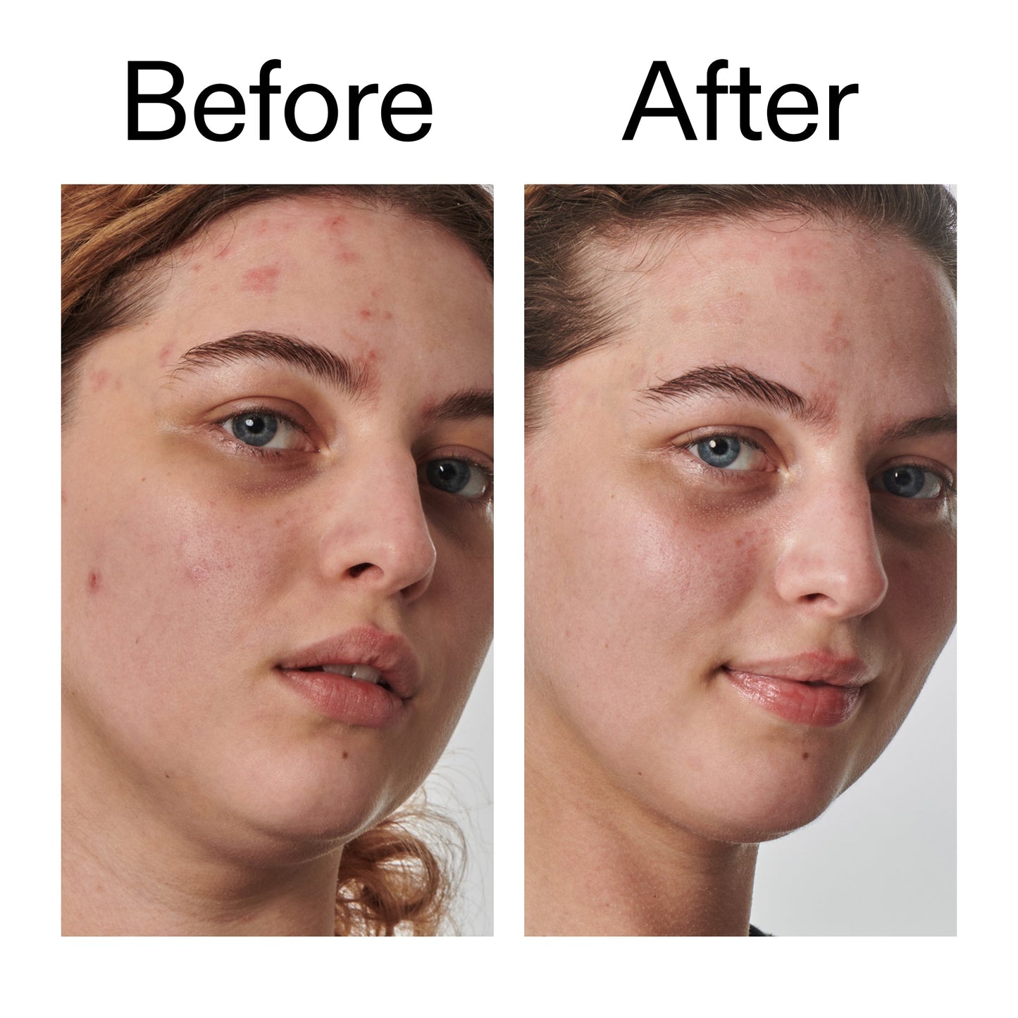 10-urea-moisturizer-b9 Dry_and_Rough_Skin_Solution_Before_After_2000x2000_efa6e639-5c39-49bd-a5dd-f0220293120a.jpg