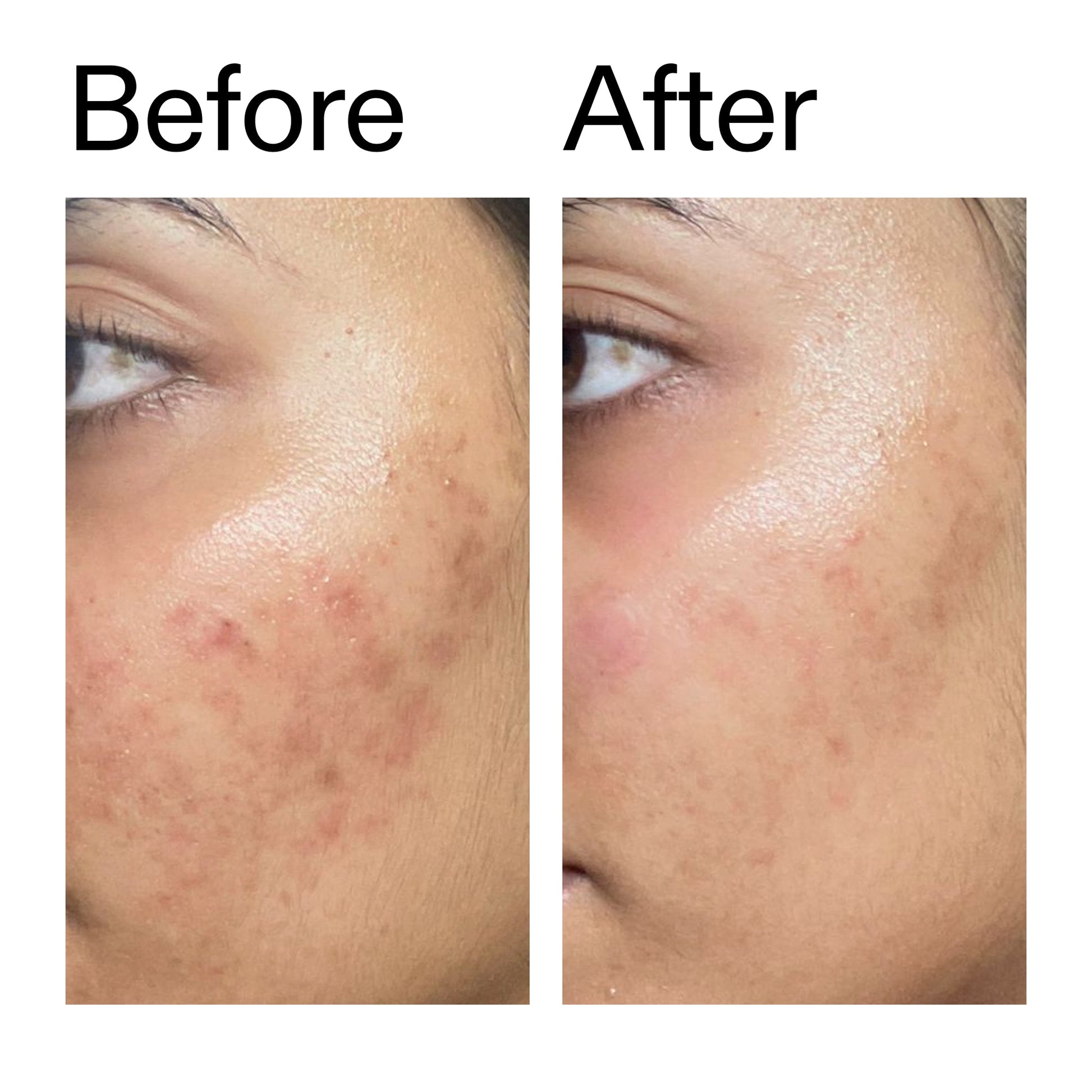 ectoin-hydro-barrier-serum-duo-s2 Ectoin_Hydro-barrier_Serum__Before_After_2000x2000_34261920-d004-48d0-9c7b-8e1c15971bfd.jpg