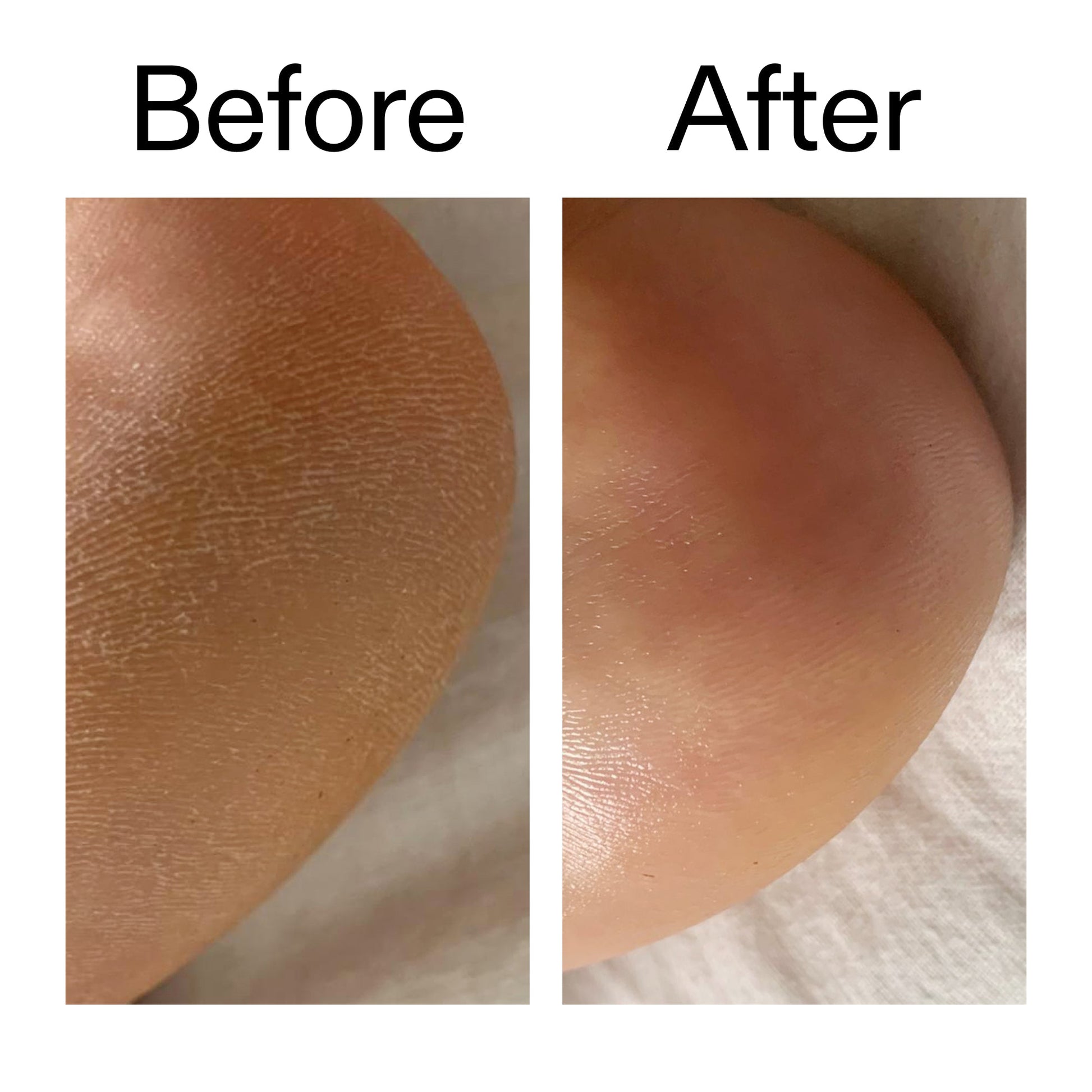 glycolic-acid-exfoliating-body-stick-g4 Glycolic_Acid_Exfoliating_Body_Stick_Before_After_V1_2000x2000_a3043625-9400-429a-a7fb-d6dbd220f722.jpg