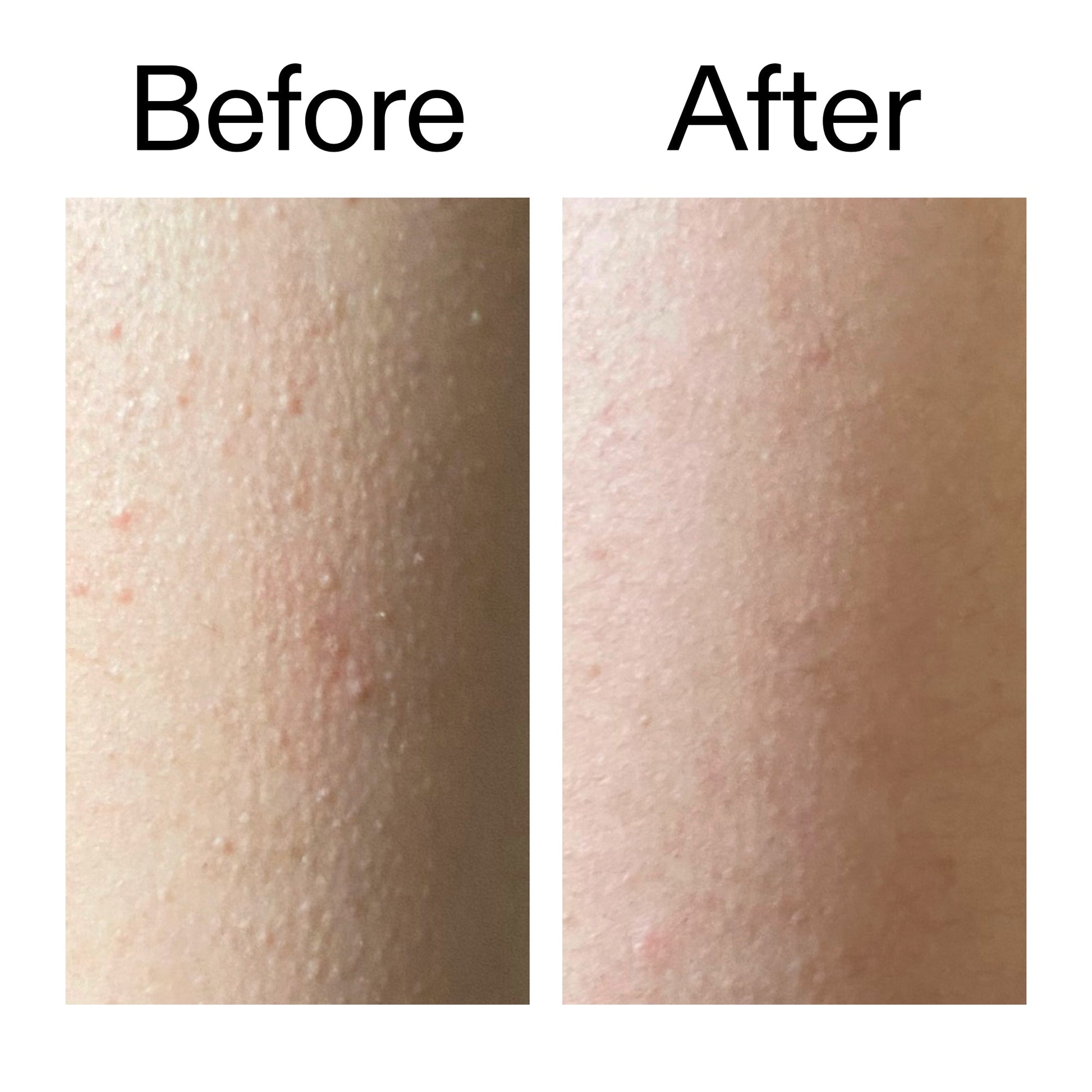 glycolic-acid-exfoliating-body-stick-g4 Glycolic_Acid_Exfoliating_Body_Stick_Before_After_V2_2000x2000_2e4ba052-94f6-4d56-82df-7bdb5b2df7ae.jpg