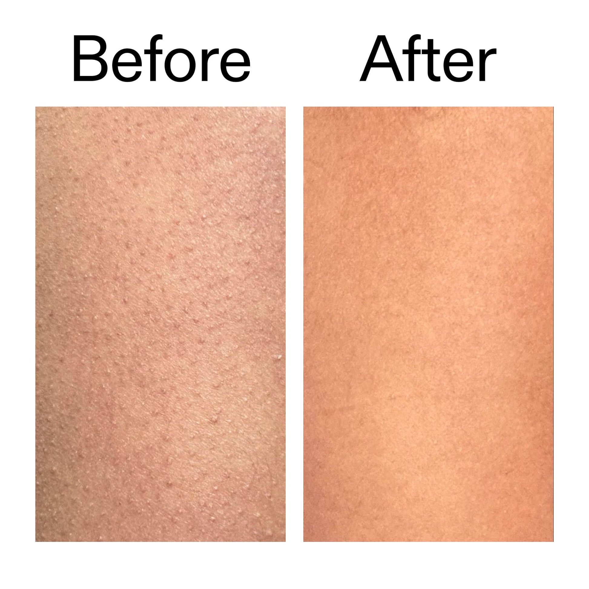 glycolic-acid-exfoliating-body-stick-g4 Glycolic_Body_Stick_B_A_2000x2000_6e6e6b4d-5bd7-43c0-aeed-4d66788e8995.jpg