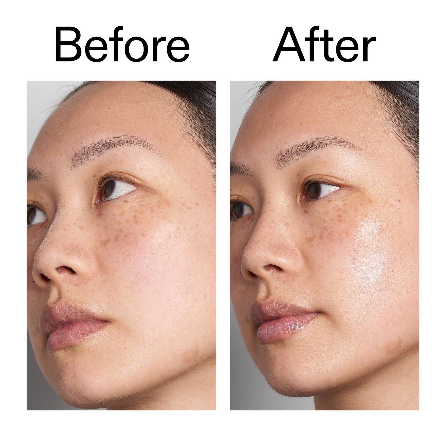 hyaluronic-acid-serum-30ml-z9 Hyaluronic_Acid_Before_After_2000x2000_d7983956-8aa2-4ea3-8255-c63e8d4f892e.jpg