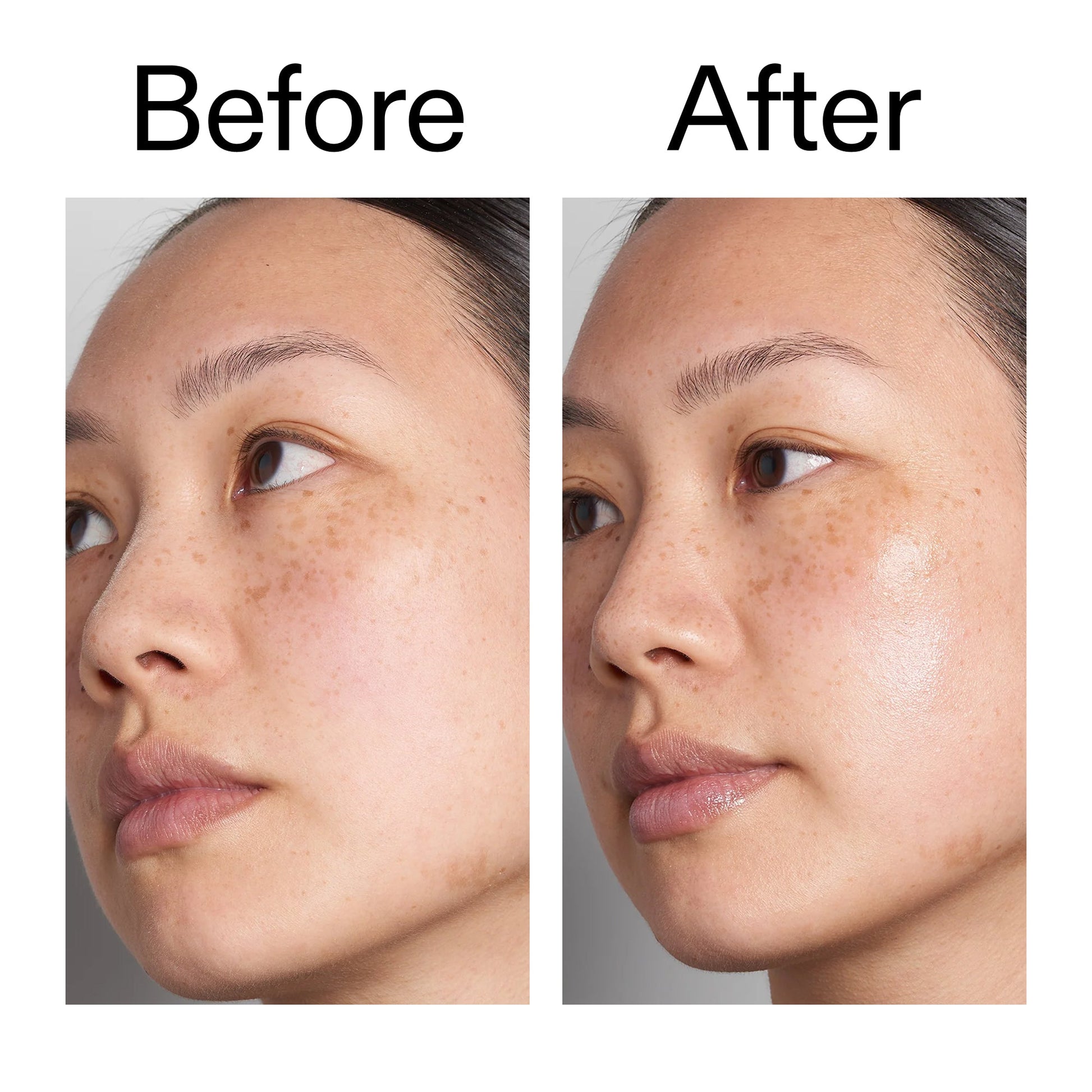 supersize-hyaluronic-acid-serum-100ml-duo-a8 Hyaluronic_Acid_Before_After_2000x2000_d7983956-8aa2-4ea3-8255-c63e8d4f892e.jpg