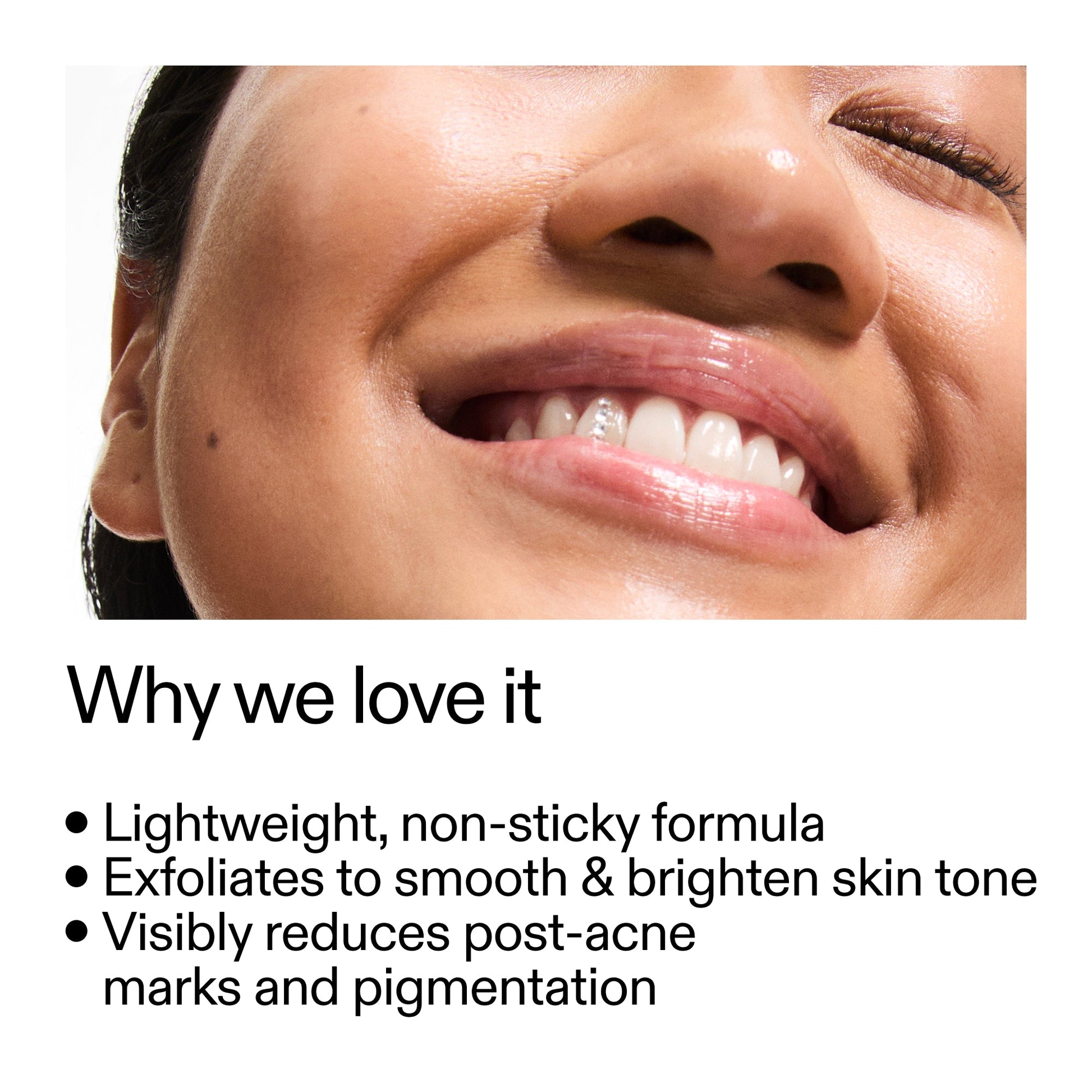 mandelic-acid-treatment-j5 Mandelic_Acid_Treatment_Why_we_love_it_2000x2000_6dfe29a9-2a79-464f-a5e8-e5ac37d93388.jpg