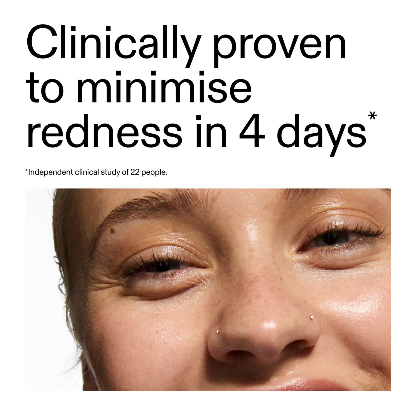 10-azelaic-acid-serum-for-redness-relief-j8 Oat_Cleansing_Balm_Claim_2000x2000_52a841dc-353c-4f2c-8646-3aadb604507d.jpg