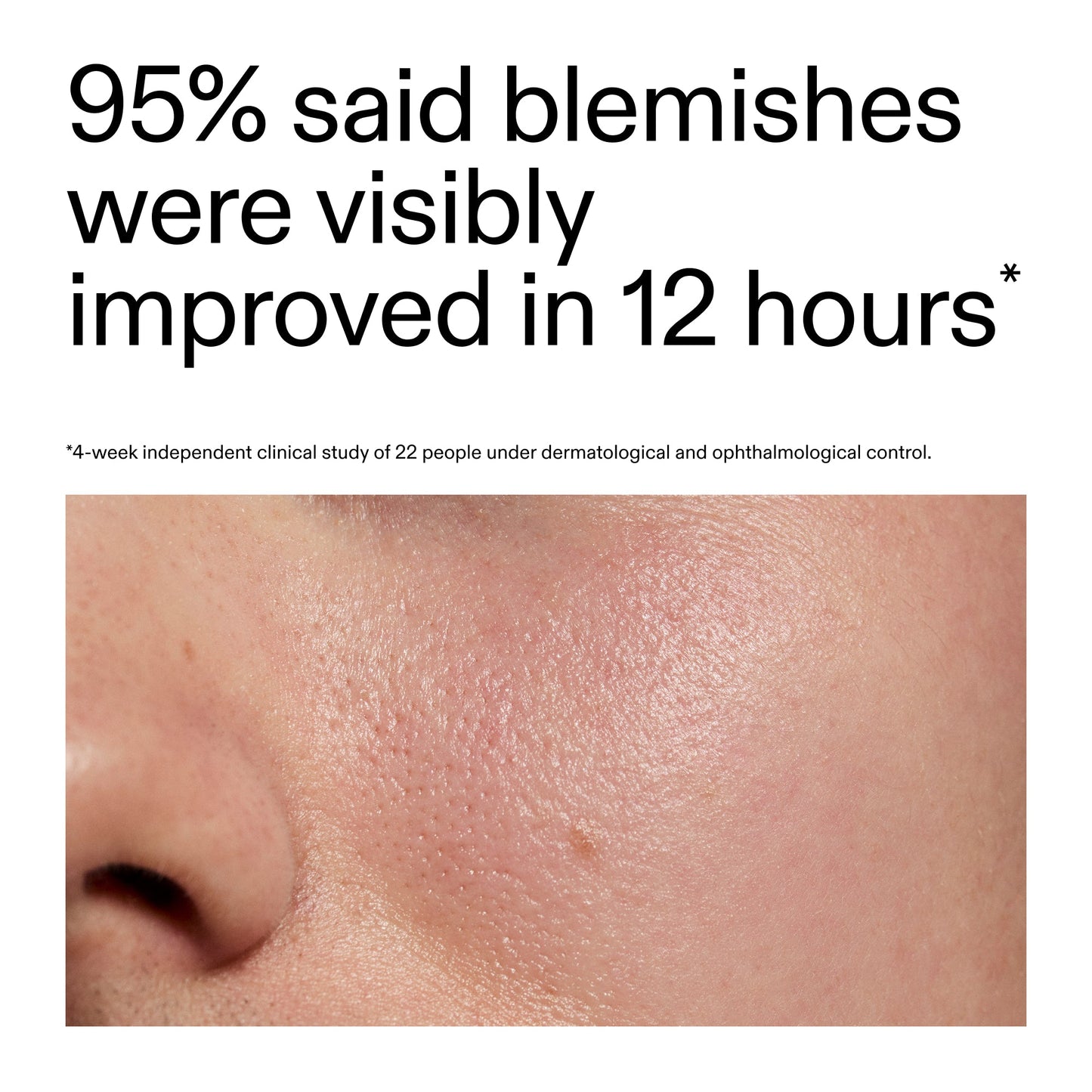 succinic-acid-acne-treatment-w8 Oat_Cleansing_Balm_Claim_2000x2000_ac6ce553-25db-41b2-a981-faae1ac4b8c0.jpg