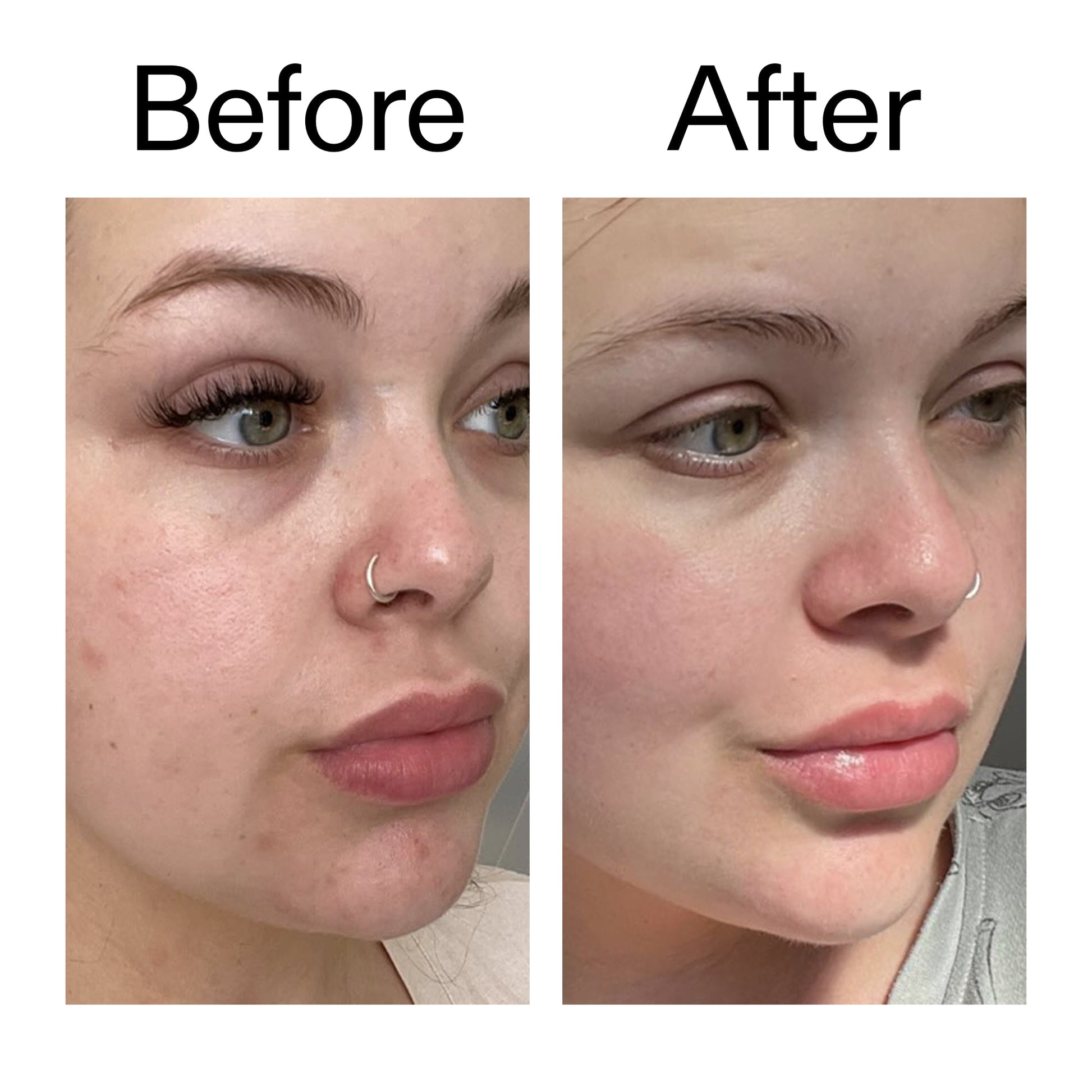 omega-water-cream-50ml-y6 Omega50_Before_After_2000x2000_46483ed8-3f9d-487f-9a0c-9df79830bd65.jpg