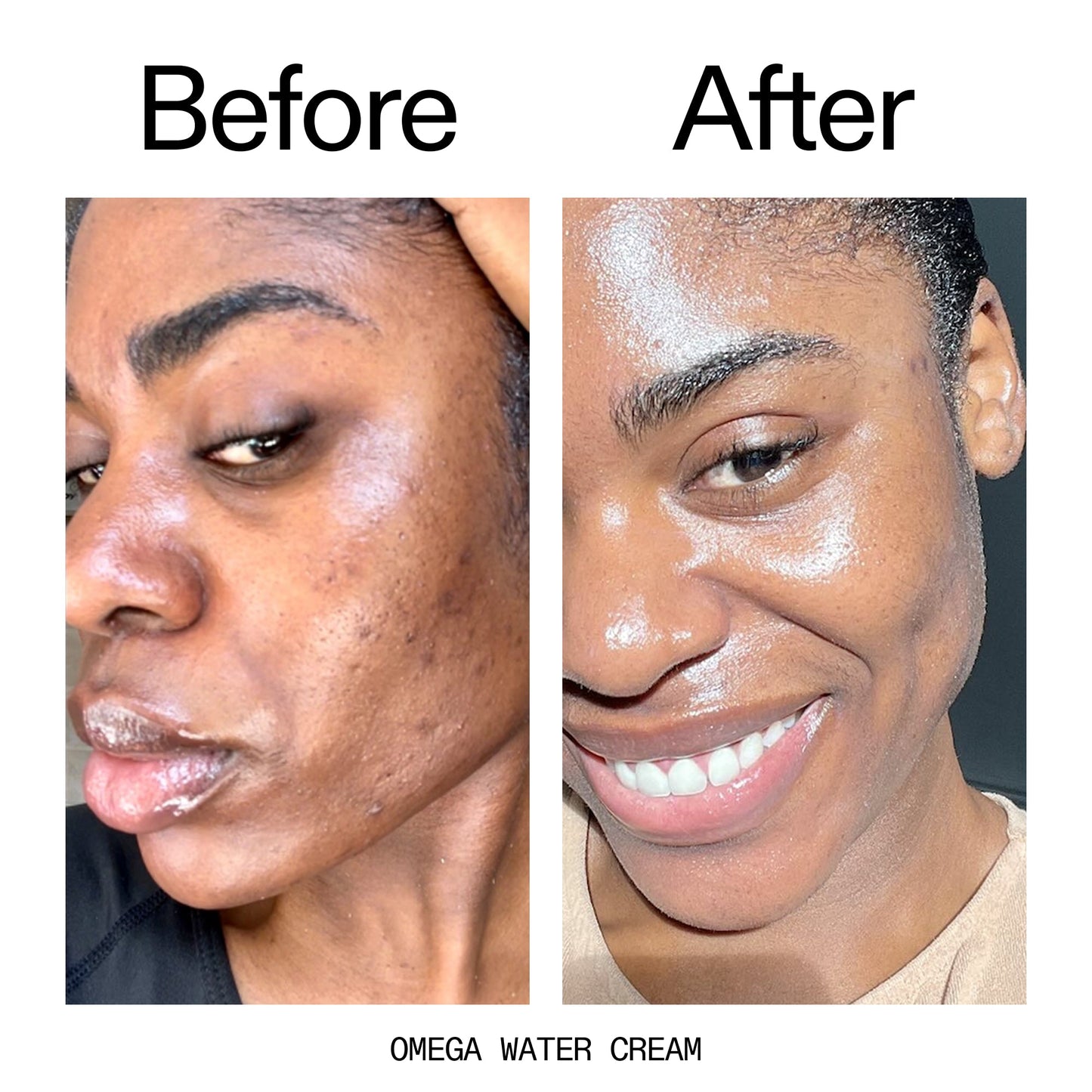 hydrating-cleanser-and-moisturizer-duo-p6 Omega_Water_Cream_Before_After_2000x2000_8e88278b-8c8d-48dc-ac77-4e98ebbd1b77.jpg