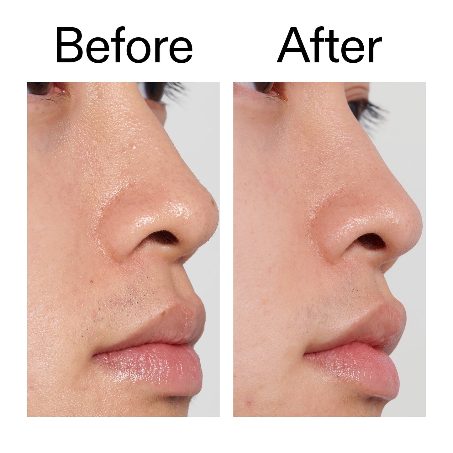 pha-toner-p2 PHA_Toner_Before_After_2000x2000_e3c10172-0150-4342-8b95-57417eaff50d.jpg
