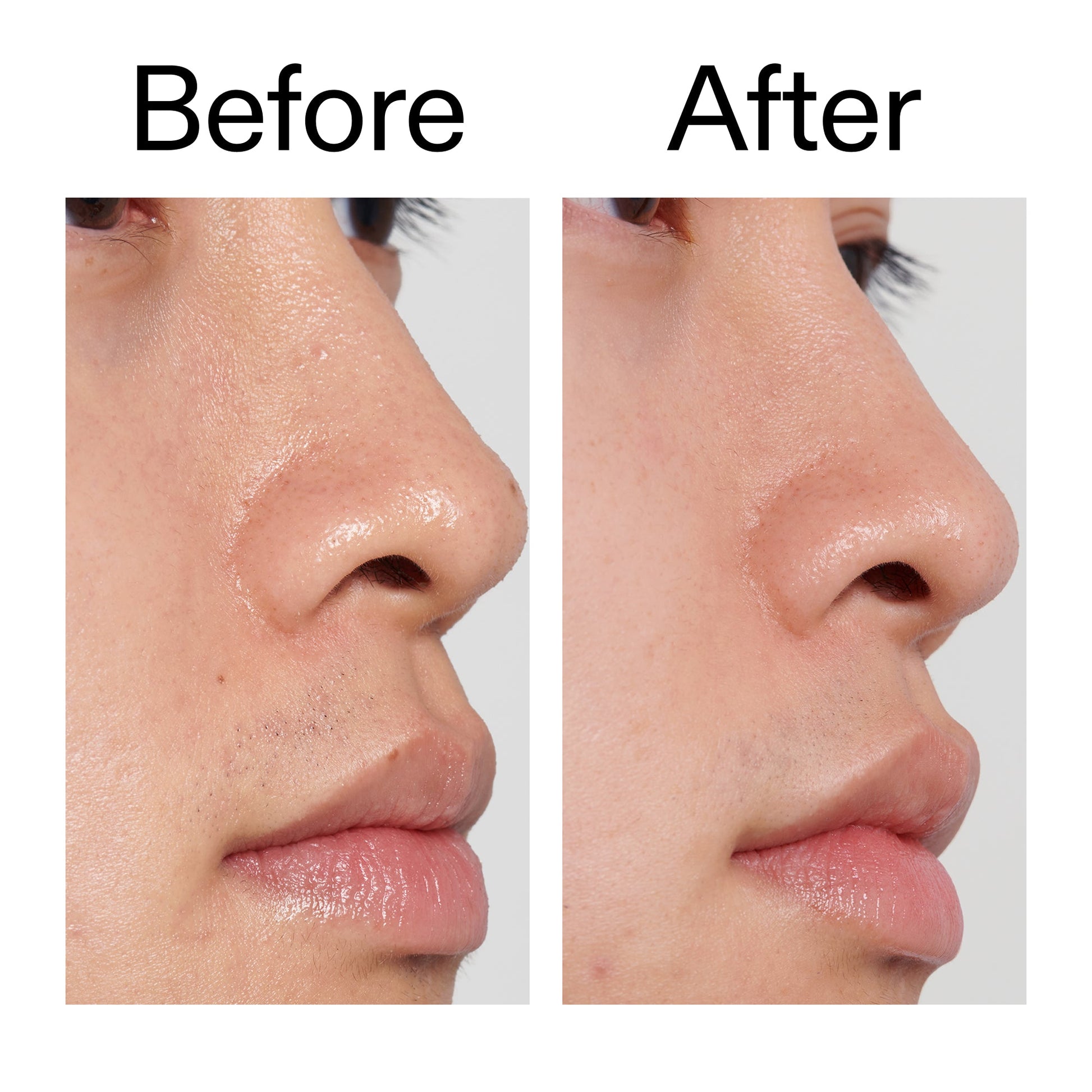 pha-toner-p2 PHA_Toner_Before_After_2000x2000_e3c10172-0150-4342-8b95-57417eaff50d.jpg