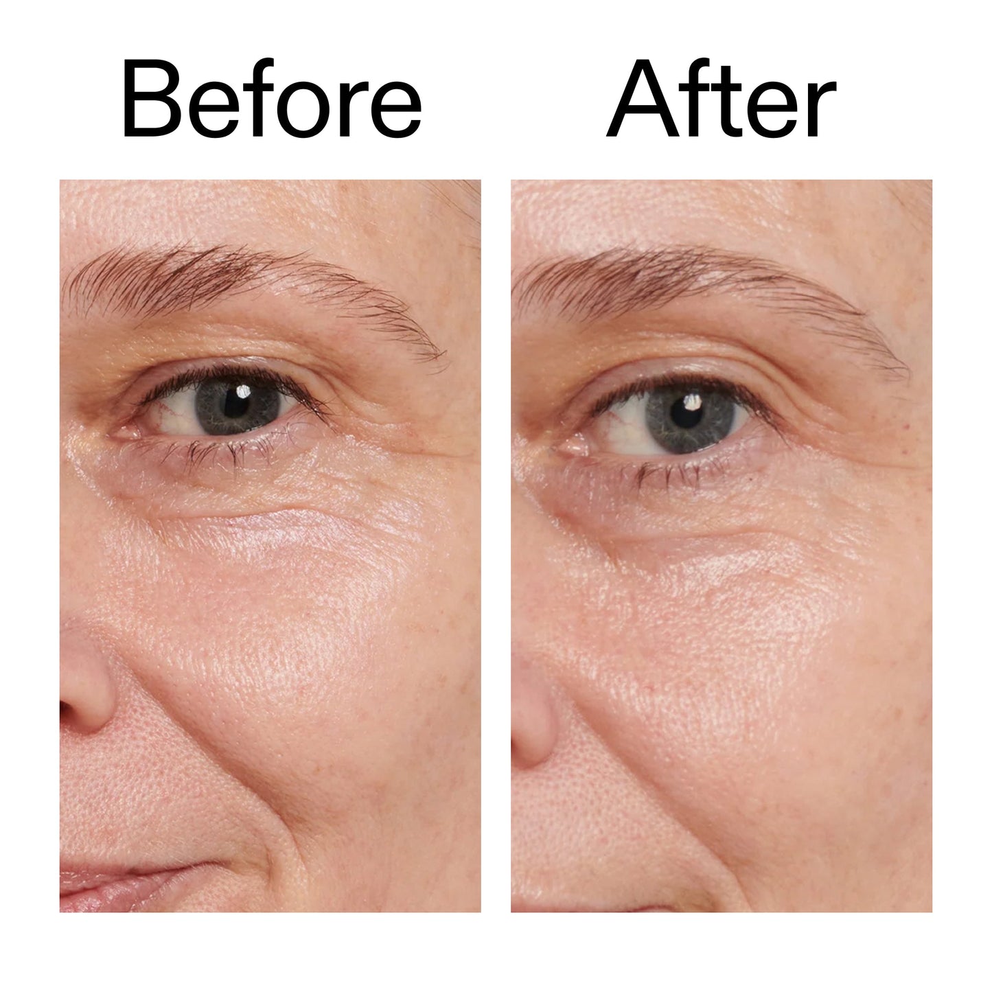 retinol-eye-cream-x6 Retinol_Eye_Cream_Before_After_2000x2000_ac03a80c-109e-4572-a95a-91dc109b4d27.jpg