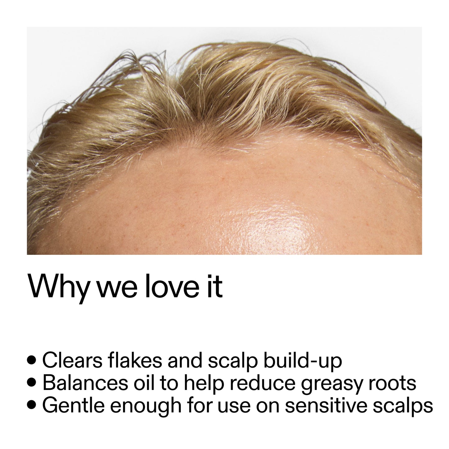 salicylic-acid-exfoliating-scalp-treatment-c9 Salicylic_Acid_Exfoliating_Scalp_Treatment_Why_we_love_it_2000x2000_44b6bd6d-9ec4-4b23-9dc4-bc3fd6f28e14.jpg