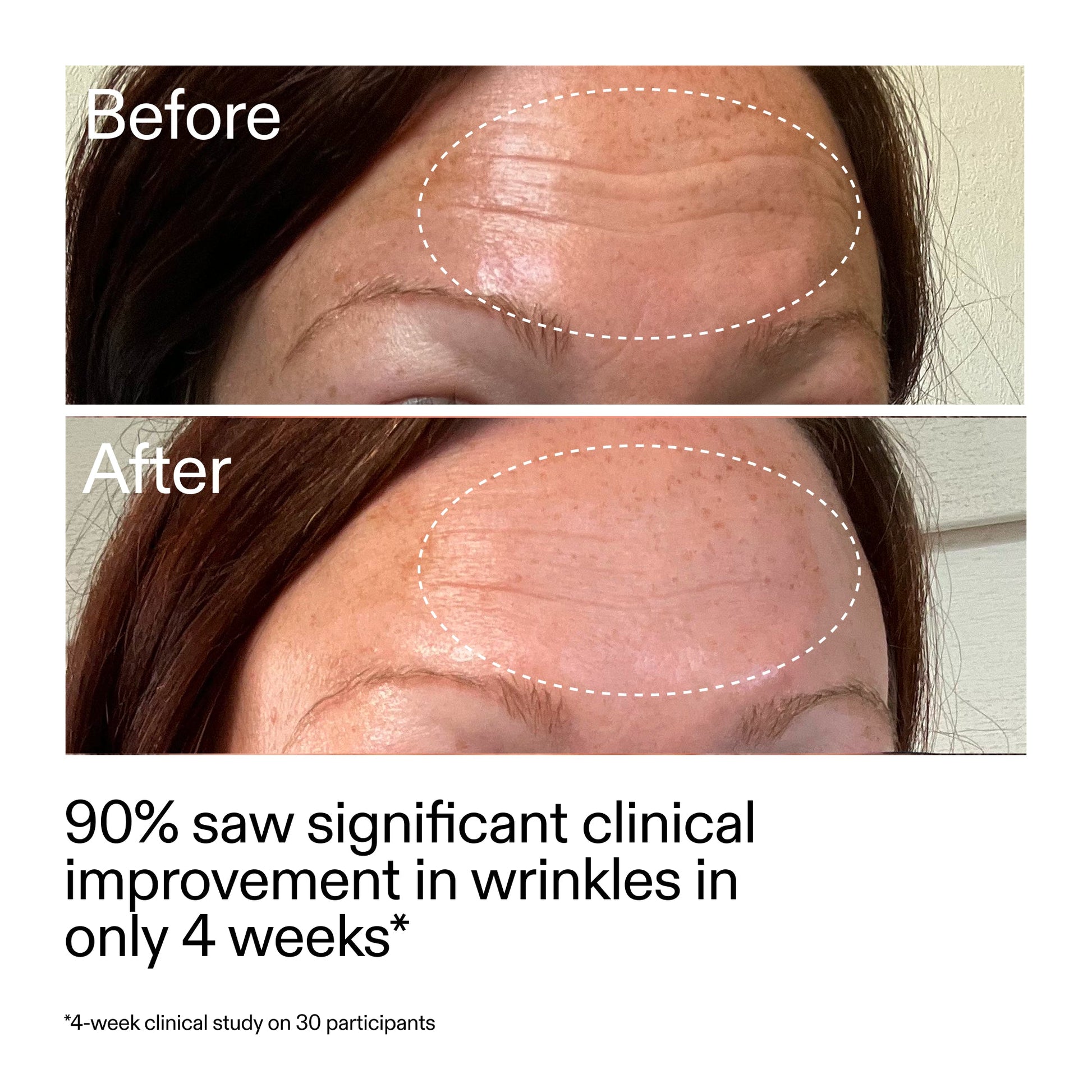 starter-retinol-serum-m9 StarterRetinol_BeforeAfter_Claim1_2000x2000_a09b50b6-4688-4527-abae-21bd142b89b7.jpg