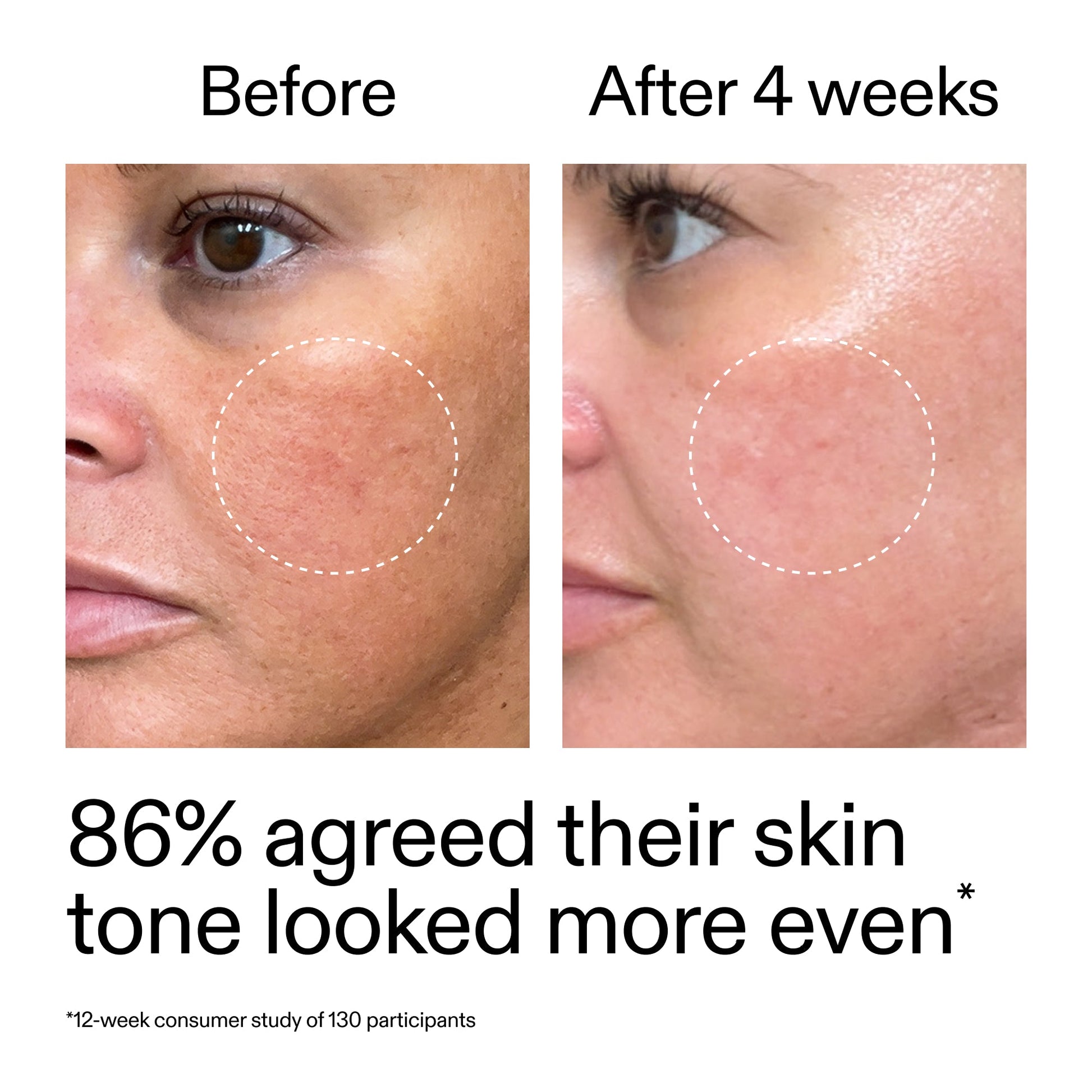 starter-retinol-serum-m9 StarterRetinol_BeforeAfter_Claim2_2000x2000_f5c9ecc0-8d76-429d-bef5-c3a61bcf5c09.jpg