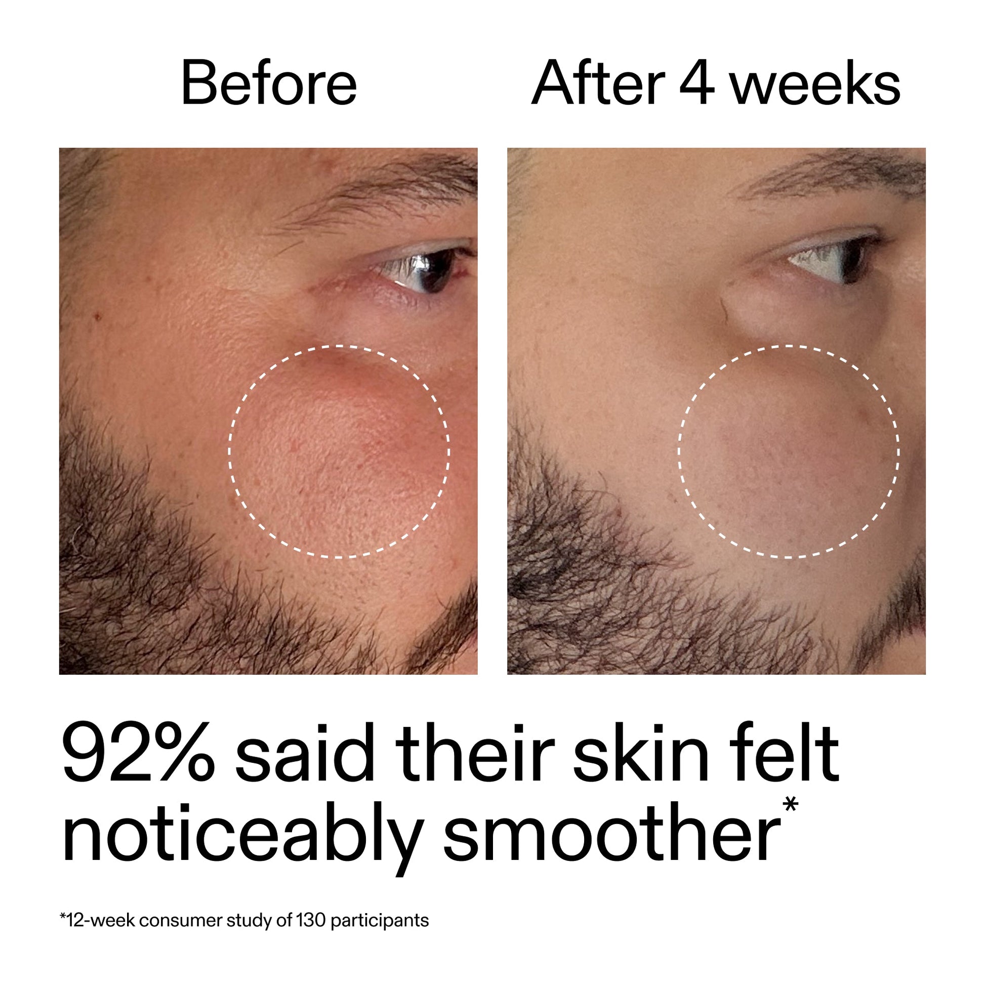 starter-retinol-serum-m9 StarterRetinol_BeforeAfter_Claim3_2000x2000_6ceab106-e0ee-4ed4-ba62-41bc39538038.jpg