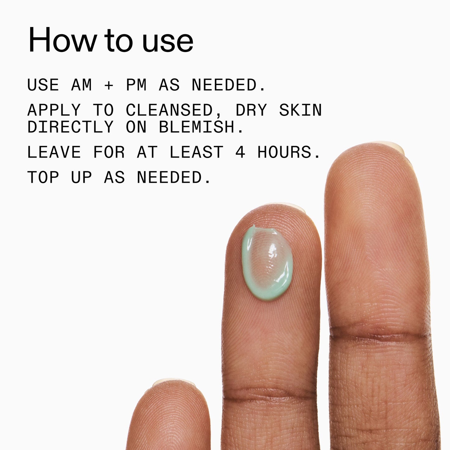 succinic-acid-acne-treatment-w8 Succinic_Acid_Treatment_How_to_Use_2000x2000_d57137d5-d7f1-427c-9a46-5fc00c19c542.jpg