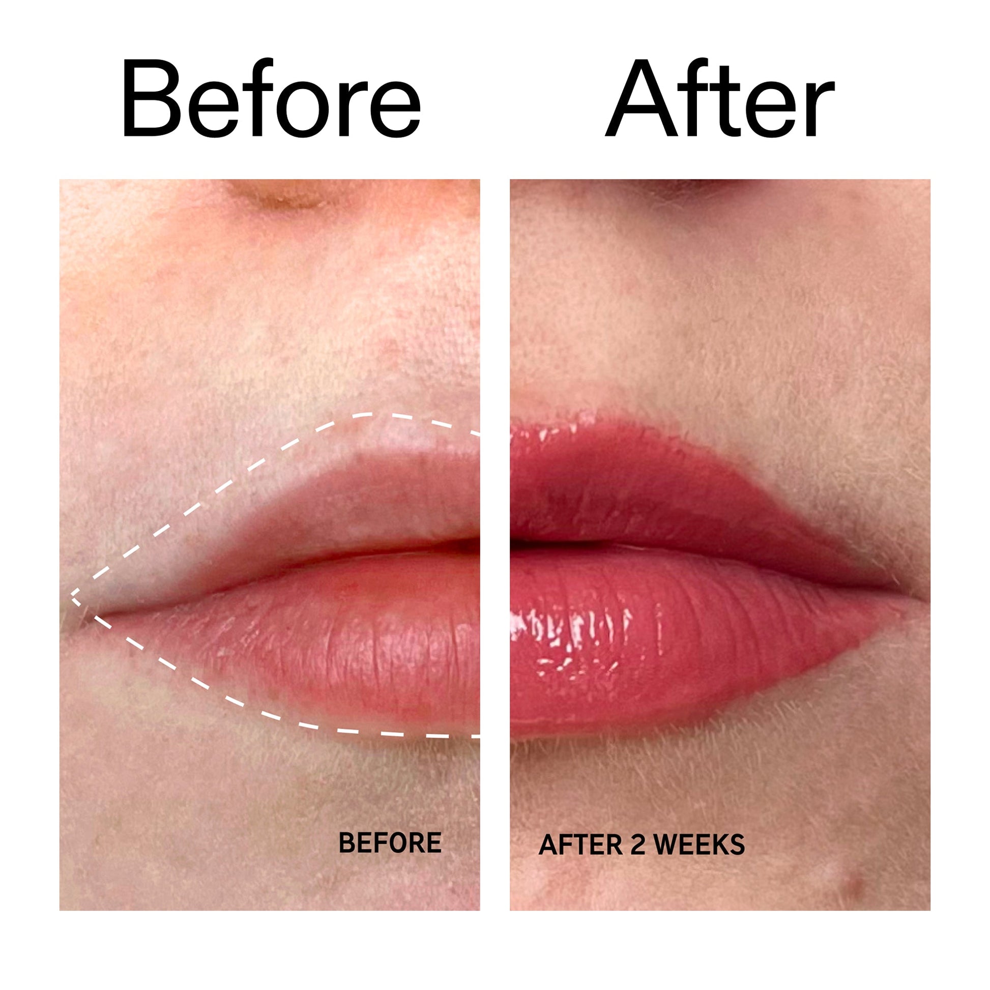tripeptide-plumping-berry-lip-balm-m5 Tripeptide_Plumping_Lip_Balm_-_Berry_Before_After_2000x2000_9474bbd8-43ca-4b0e-b0e7-dfab70b91927.jpg