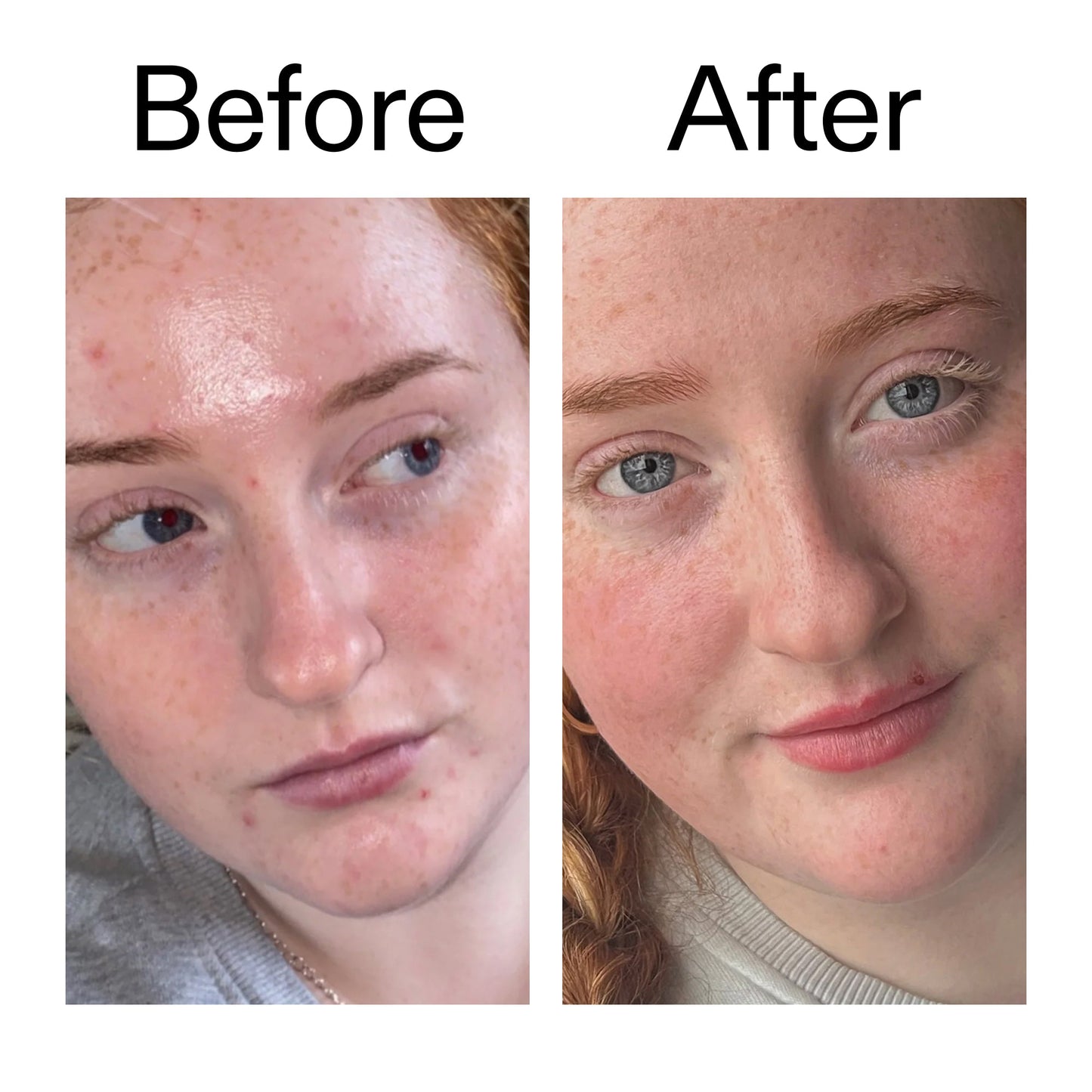 vitamin-b-c-and-e-moisturizer-g6 Vitamin_B_C_and_E_Moisturizer_Before_After_2000x2000_b0781a76-5ad2-4be9-95b8-ef92b356833c.jpg